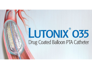 Lutonix-640x480